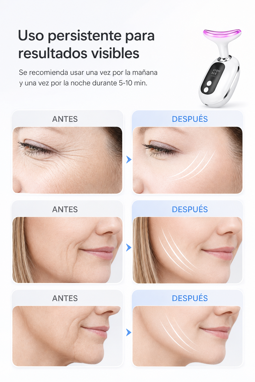 Masajeador Facial Wavi chic Rejuvenecedor  "El Secreto de Belleza de las Celebridades - ¡Para Ti!"